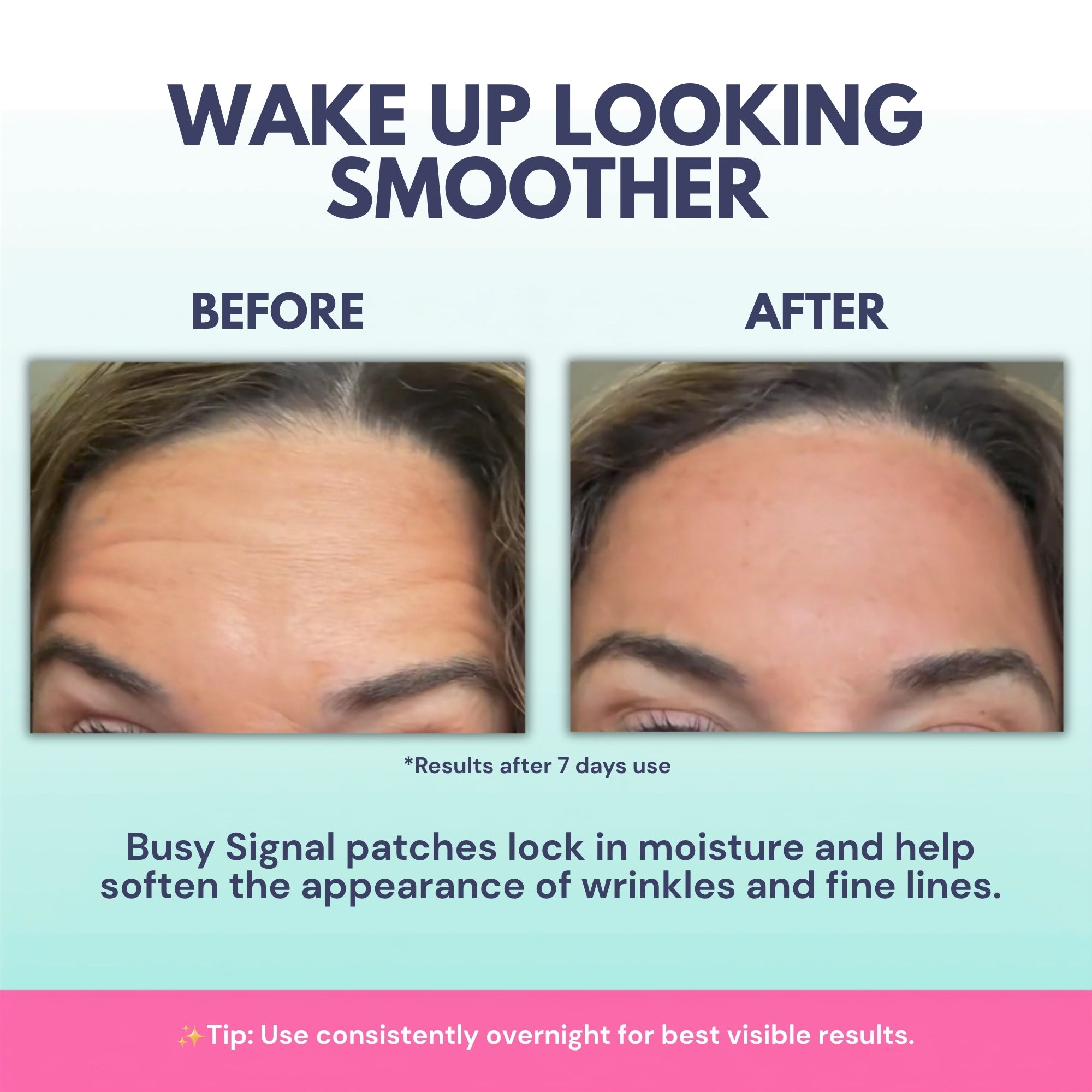 Forehead Wrinkle Patches